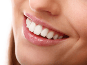Signs that you need cosmetic dentistry.
