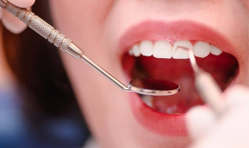 Close-up of dental examination with mirror tool inspecting patient's teeth and smile.