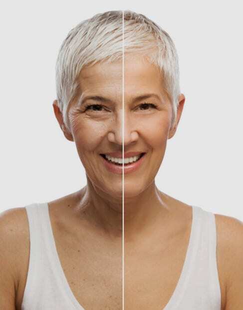 Woman smiling showing results of dental care at Puyallup dental practice.