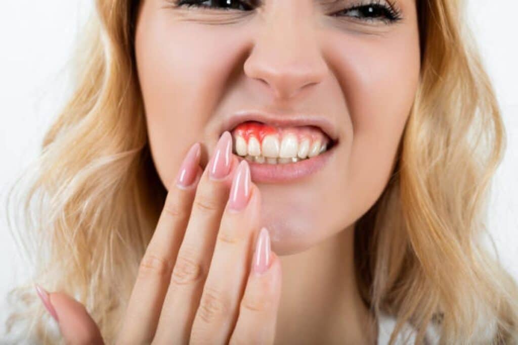 Woman with gum inflammation holding her cheek in pain during dental treatment.