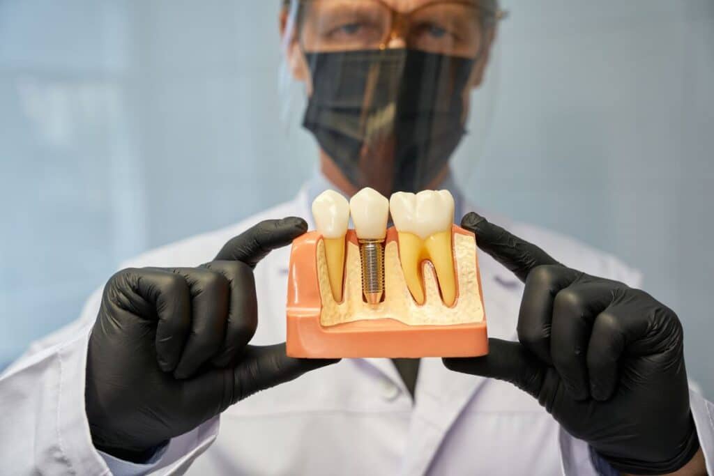 Dentist displaying dental implant model showing tooth replacement options in Puyallup.