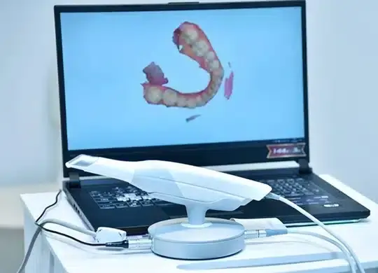 Intraoral camera displaying detailed 3D scan of patient's teeth and jaw structure.