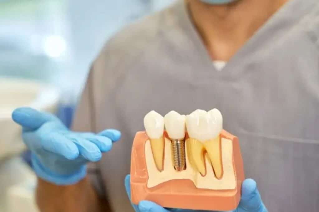 Dentist holding dental implant model showing tooth replacement procedure with crown and screw component.
