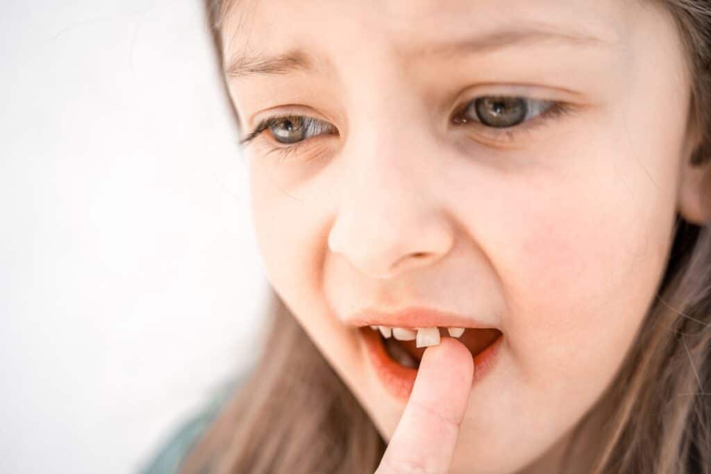 Child with missing front tooth pointing to mouth during emergency dental examination.