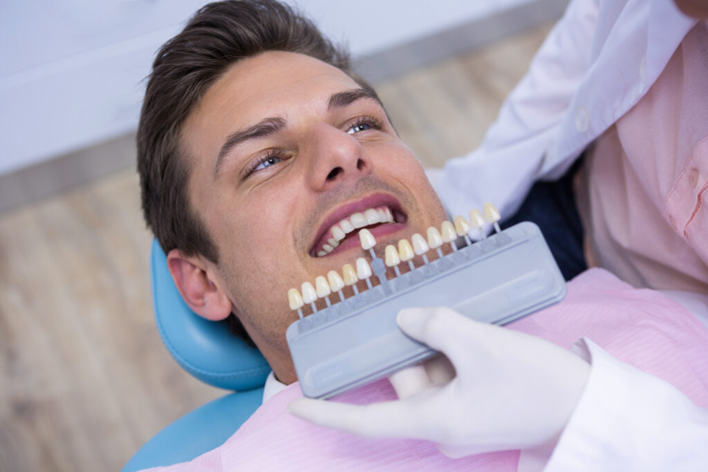Veneers in Summit
